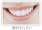 歯を白くしたい
