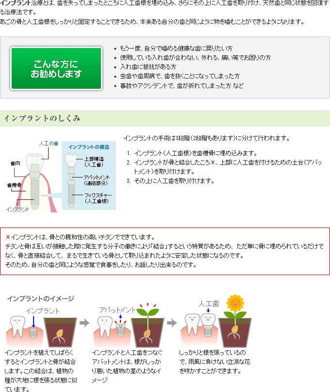 インプラントとは