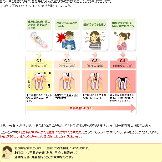 虫歯の症状について