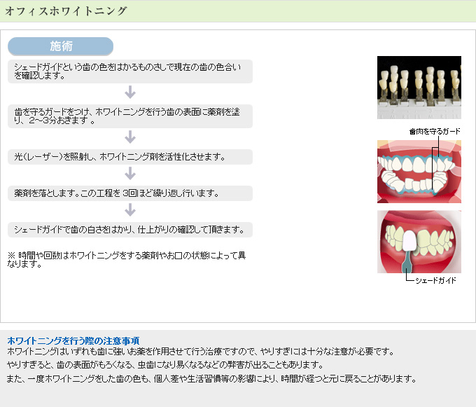 オフィスホワイトニング