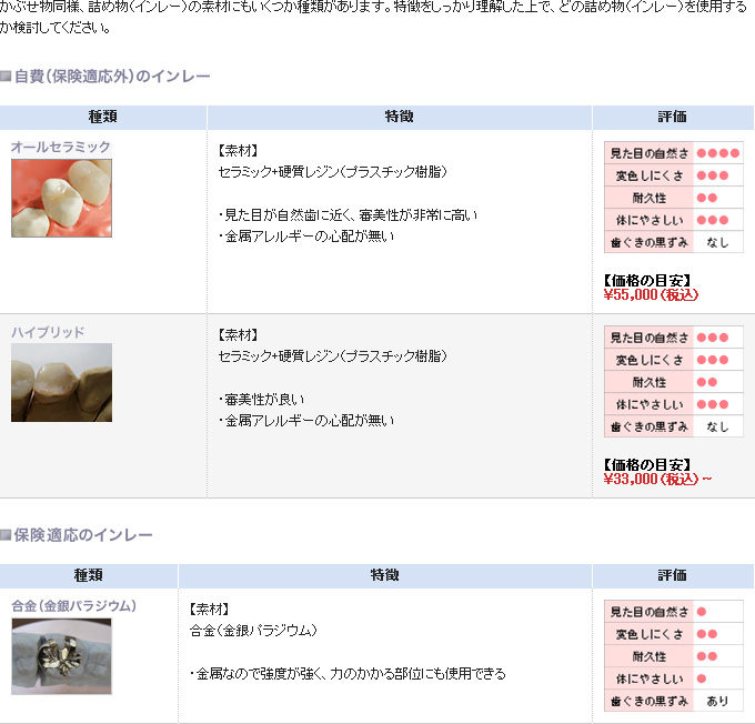 インレーの種類と特徴